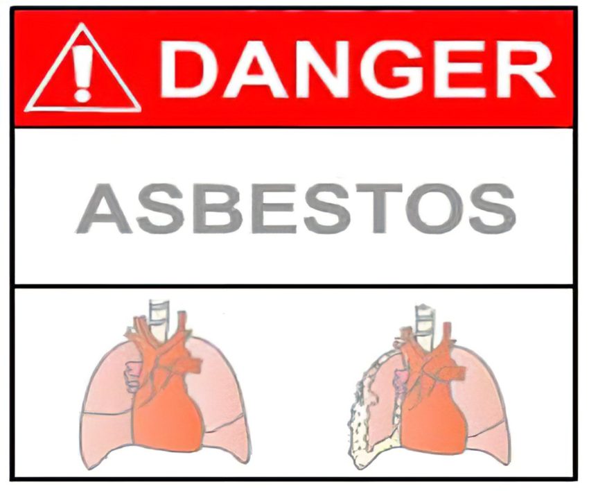 Asbestos Exposure Lawsuit