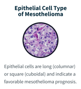 malignant mesothelioma epithelioid type