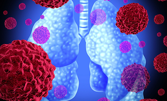 immunotherapy for mesothelioma cost