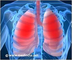 surgery for malignant pleural mesothelioma