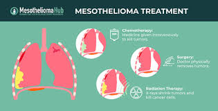 mesothelioma treatment and prognosis