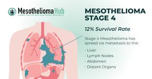 stage 4 mesothelioma survival rate