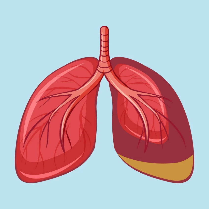 mesothelioma diagnosis and treatment