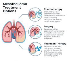 mesothelioma stage 3 treatment