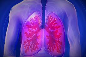 mesothelioma lung cancer attorneys