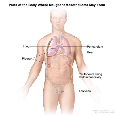 new clinical trials for mesothelioma